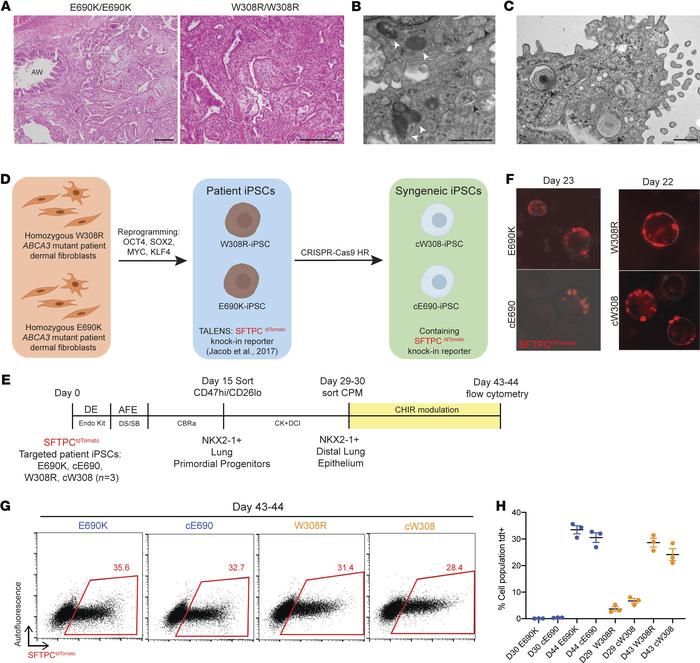 Generation and directed differentiation of patient-specific ABCA3 mutant and syngeneic gene-corrected iPSC lines produces SFTPCtdTomato-expressing iAEC2s.