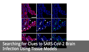 Searching for Clues to SARS-CoV-2 Brain Infection Using Tissue Models