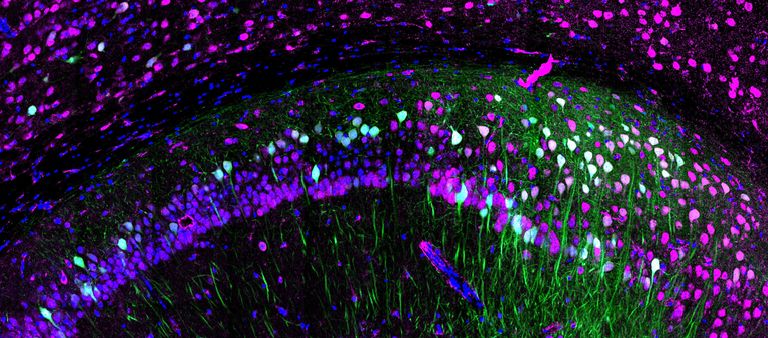 microscopic view of stained brain cells