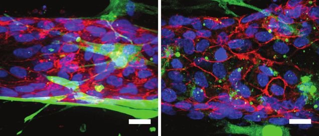 Blood vessel with no RhoA protein activity keeps its barrier function (left), but when the researchers activated RhoA only in the mural cells, barrier function was lost (right).