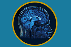 brain.jpg