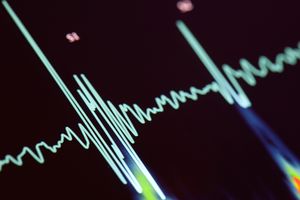 ekg heartbeat trace