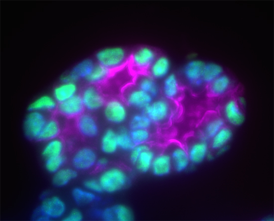 Thyroid follicles grown from stem cells. These produced enough hormone to “rescue” mice with no functioning thyroid. Courtesy of Darrell Kotton