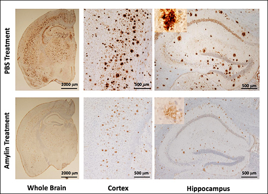 brain slices showing amylin vs. PBS