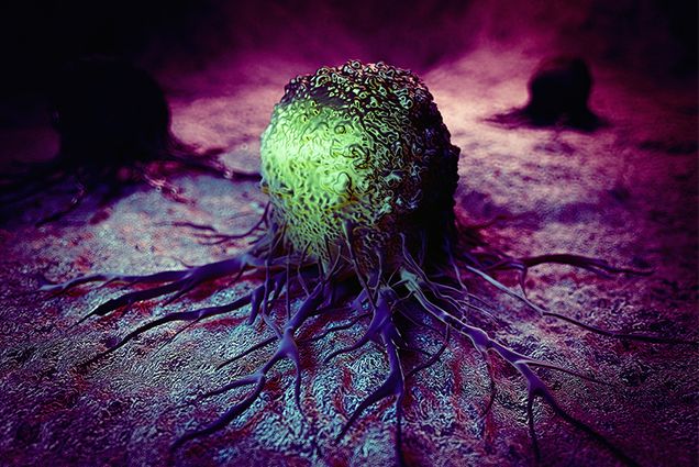 Medical illustration of cancer cell and tumor