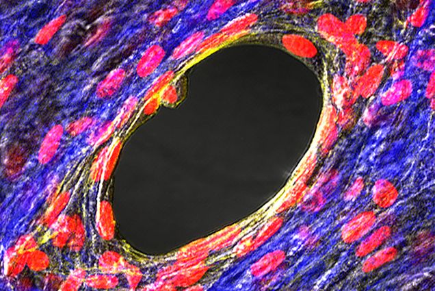 Wound in 3D microtissue