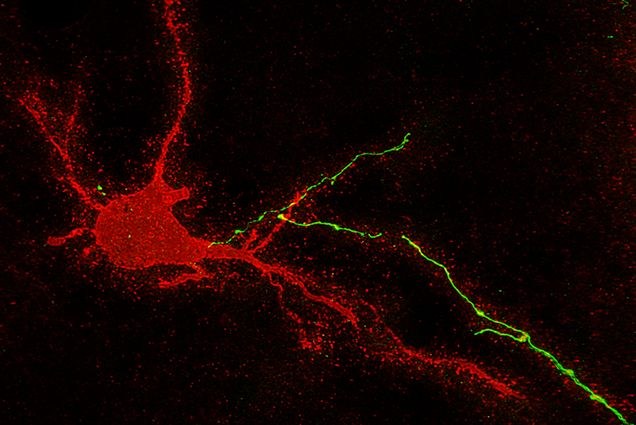 neurons in the human brain