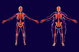 Obesity may be associated with an increased risk of progression, recurrence, and death for specific types of cancer.