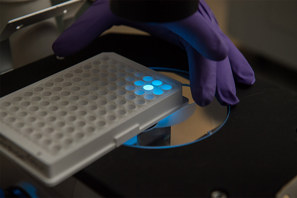 A tray containing virus is held under a flourescence microscope.