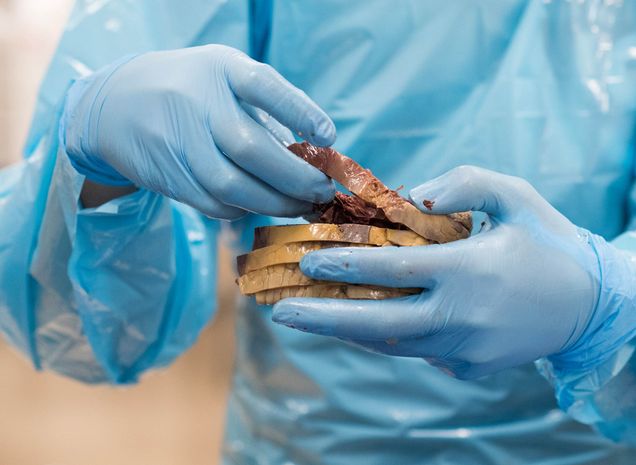 A graduate student in the Boston University Cadaver Lab advanced anatomy class holds a dissected human heart cut into layers