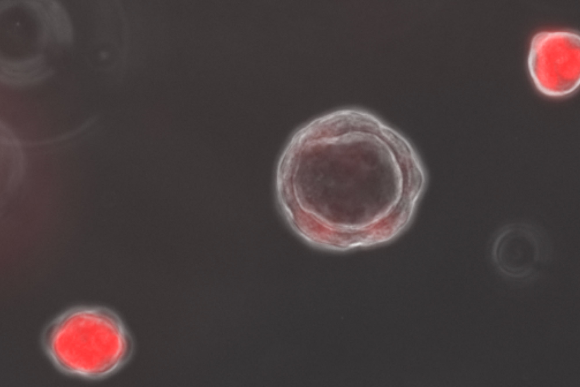 An image of red organoids on a gray background