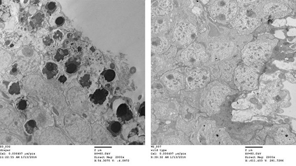 Electron micrographs of normal brain tissue (right) and brain tissue from a fly that can’t clear dead cells, shown by the black spots. Image courtesy of McCall
