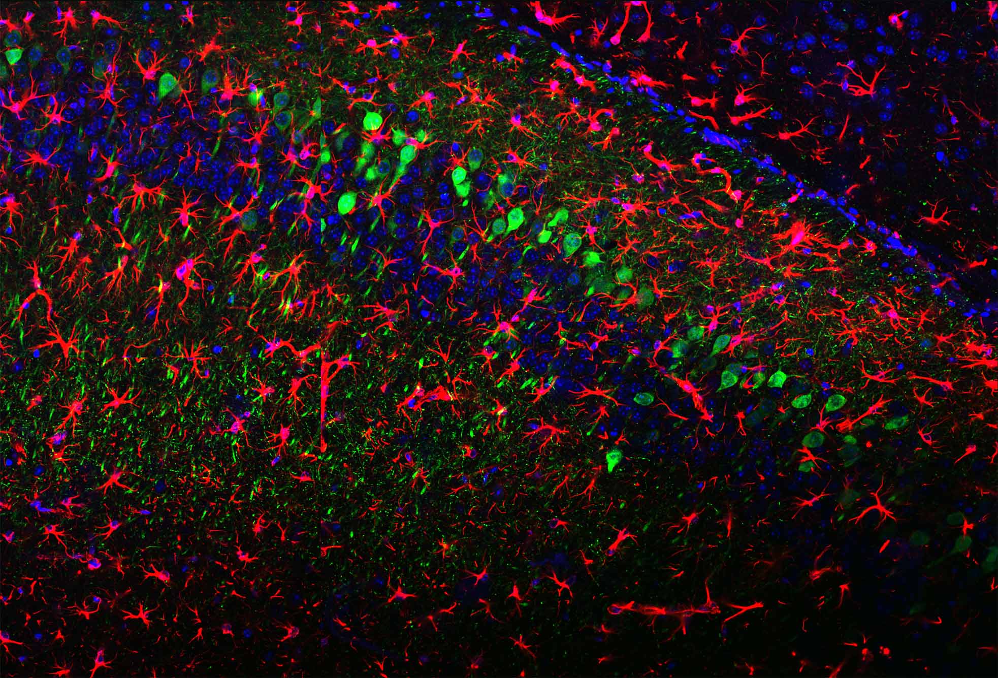 Image: A 20x image using confocal microscopy of mouse hippocampal ventral CA1. A black background with green, blue, and red splotches in a series of patterns.