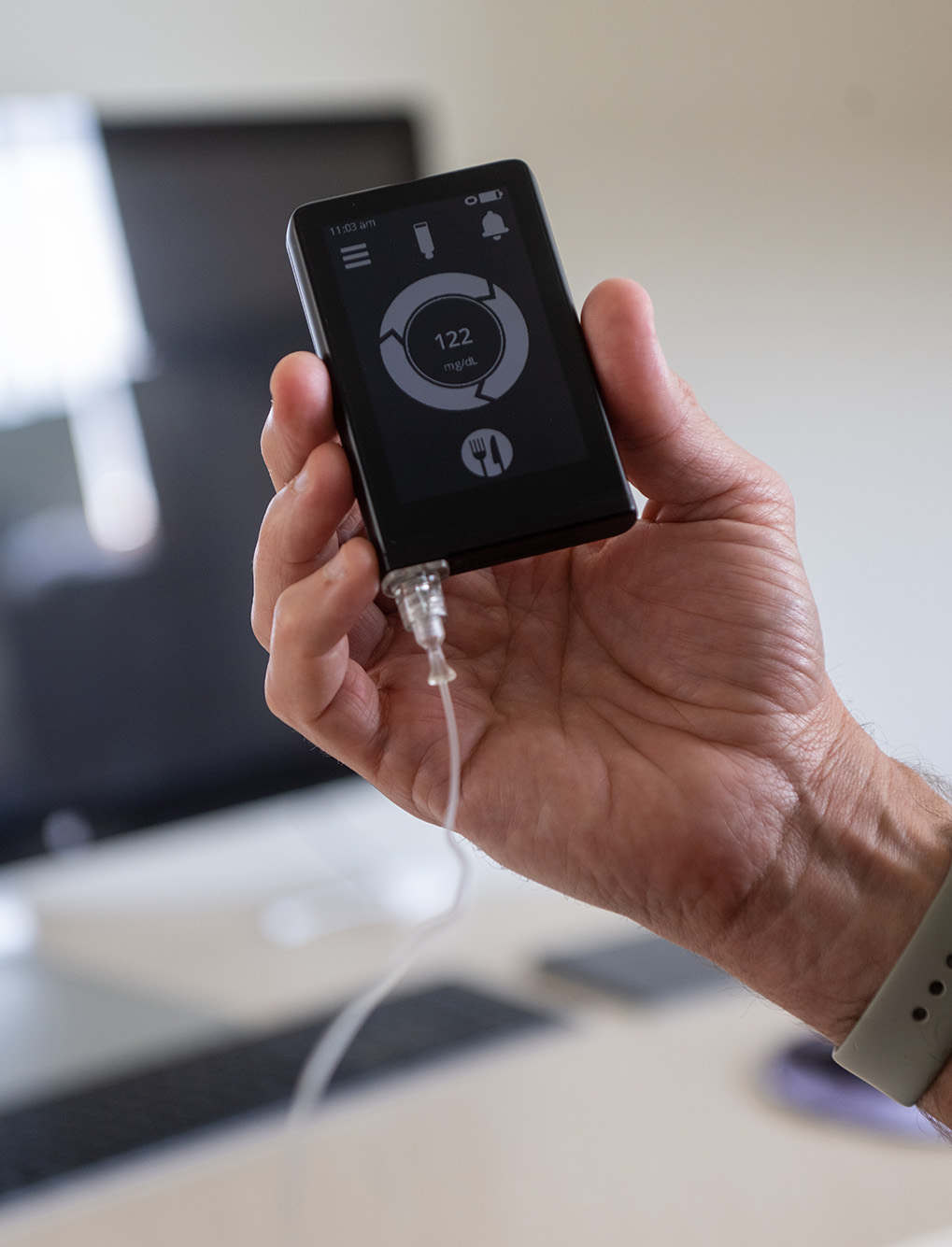Image: Photo of The iLet bionic pancreas, which automatically monitors blood glucose levels and delivers tailored insulin doses. A hand displays a small black device with silver details and display with silver buttons. Display shows the blood glucose reading and has a symbol of food on it.