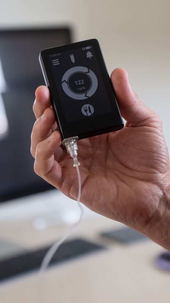 Image: Photo of The iLet bionic pancreas, which automatically monitors blood glucose levels and delivers tailored insulin doses. A hand displays a small black device with gold details and display with gold buttons. Display shows the blood glucose reading and has a symbol of food on it. Text on image reads "CAUTION: The iLet bionic pancreas is an investigational device, limited by federal (or United states) law to investigational use."
