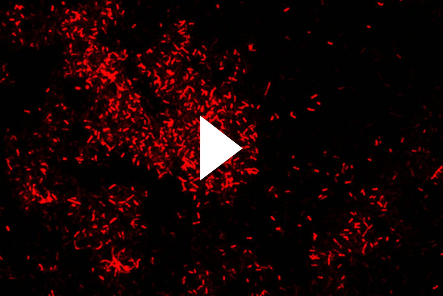 Photo: Microbes under a microscope, they appear as red and scattered. There is a video play button over the image