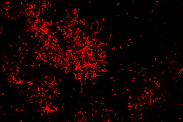 Photo: Microbes under a microscope, they appear as red and scattered
