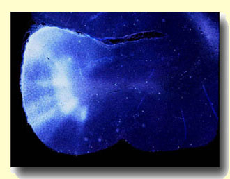 Darkfield