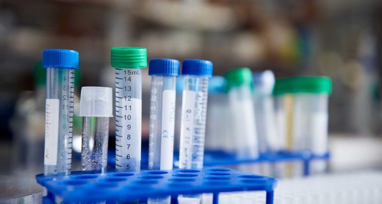 lab-tubes-experiments