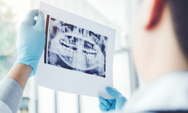 Dentist consulting with patient presenting results on dental x-ray film