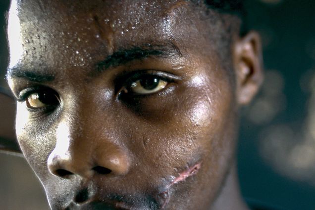 A 1996 portrait of an African National Congress supporter who was shot in the face and had his home burned the year before. 